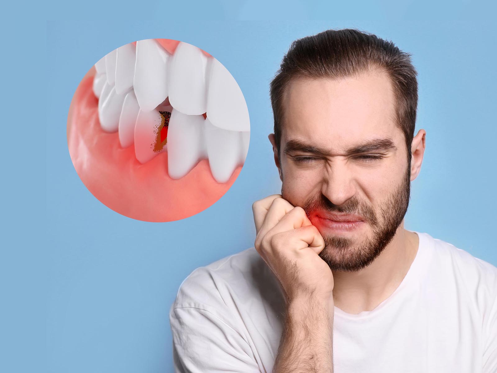 Gum Disease (Periodontal Disease) Treatment Services