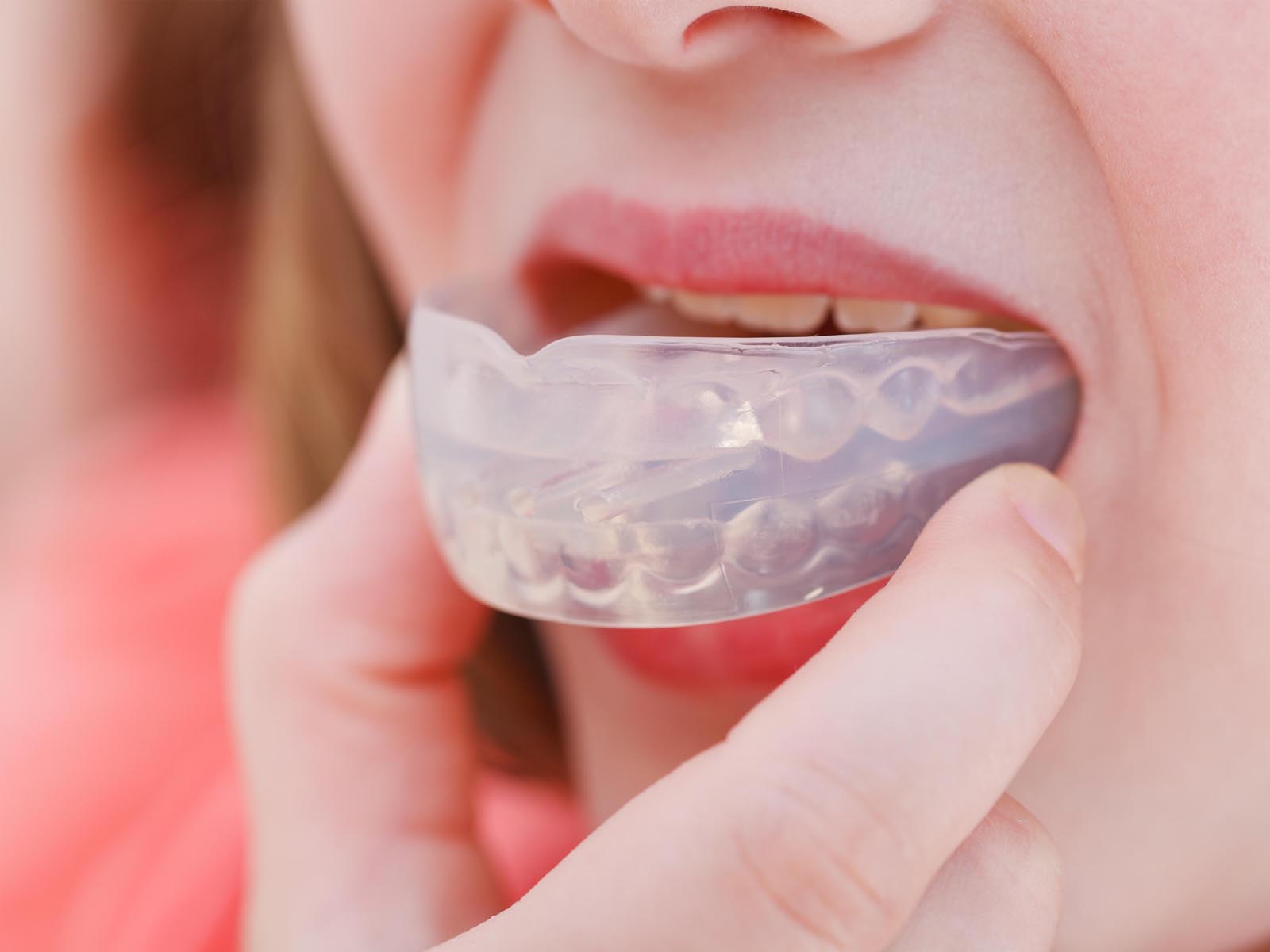 Mouth Guards and Night Guards Services