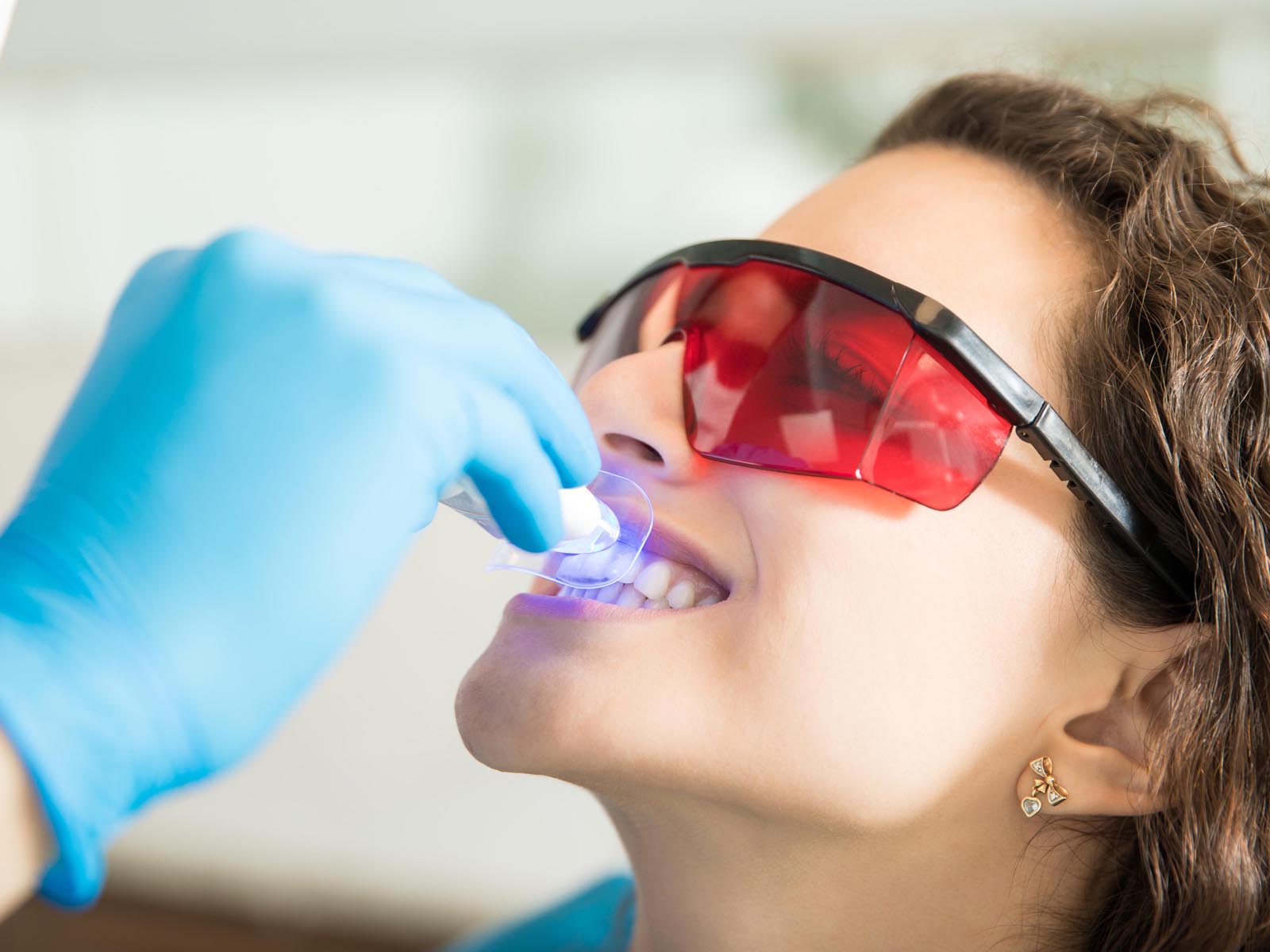 Teeth Whitening Services